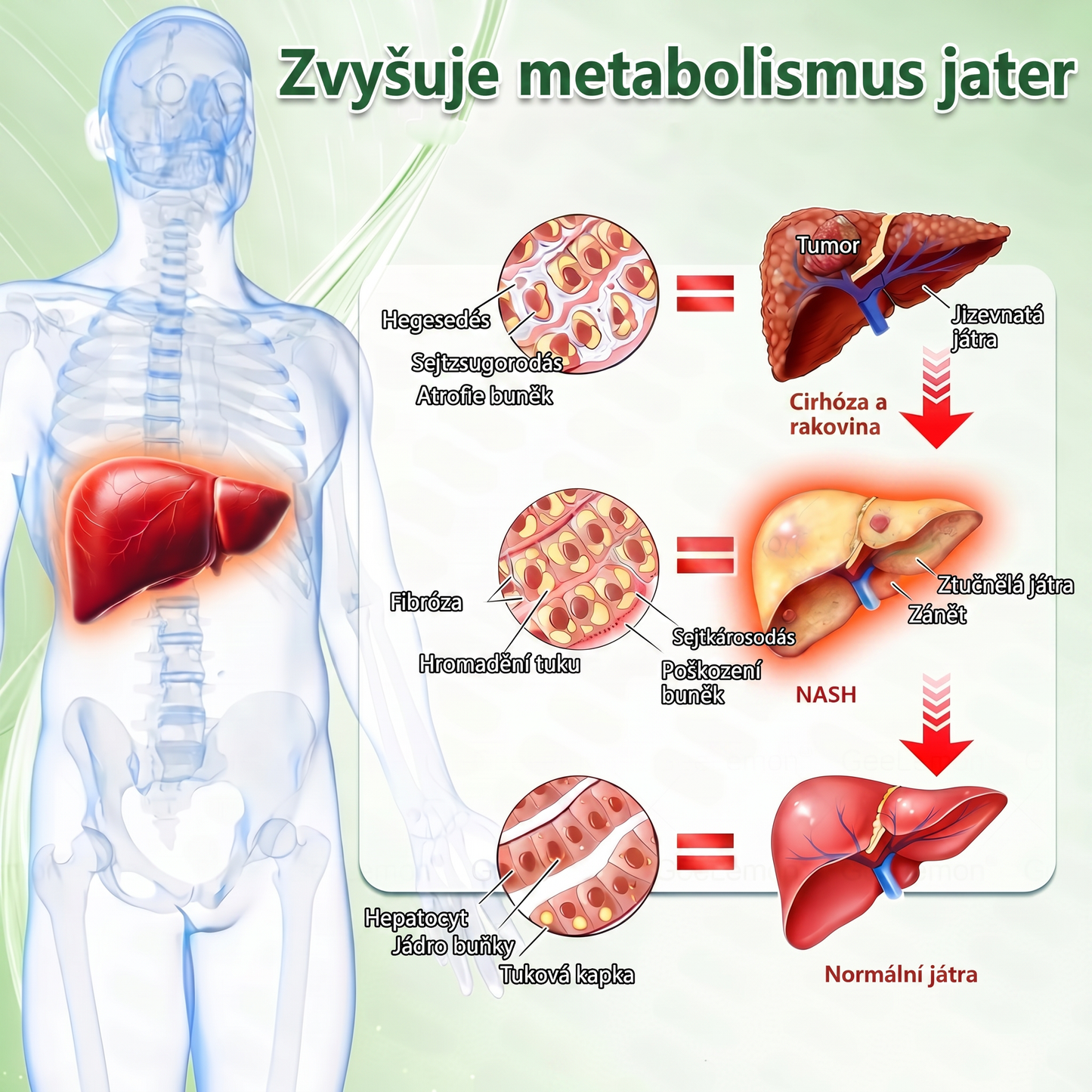 Luxarise®🌿Glumasetide 8v1 Stihla a zdrava nano mikrojehlickova naplast(1krát denně – viditelné změny až za 7 dní) ✅Pro obezitu, zpevnění kůže, cukrovku, spánkovou apnoe, klouby atd.