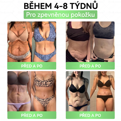Luxarise®🌿Glumasetide 8v1 Stihla a zdrava nano mikrojehlickova naplast(1krát denně – viditelné změny až za 7 dní) ✅Pro obezitu, zpevnění kůže, cukrovku, spánkovou apnoe, klouby atd.