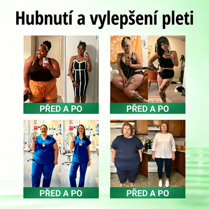 Luxarise®🌿Glumasetide 8v1 Stihla a zdrava nano mikrojehlickova naplast(1krát denně – viditelné změny až za 7 dní) ✅Pro obezitu, zpevnění kůže, cukrovku, spánkovou apnoe, klouby atd.