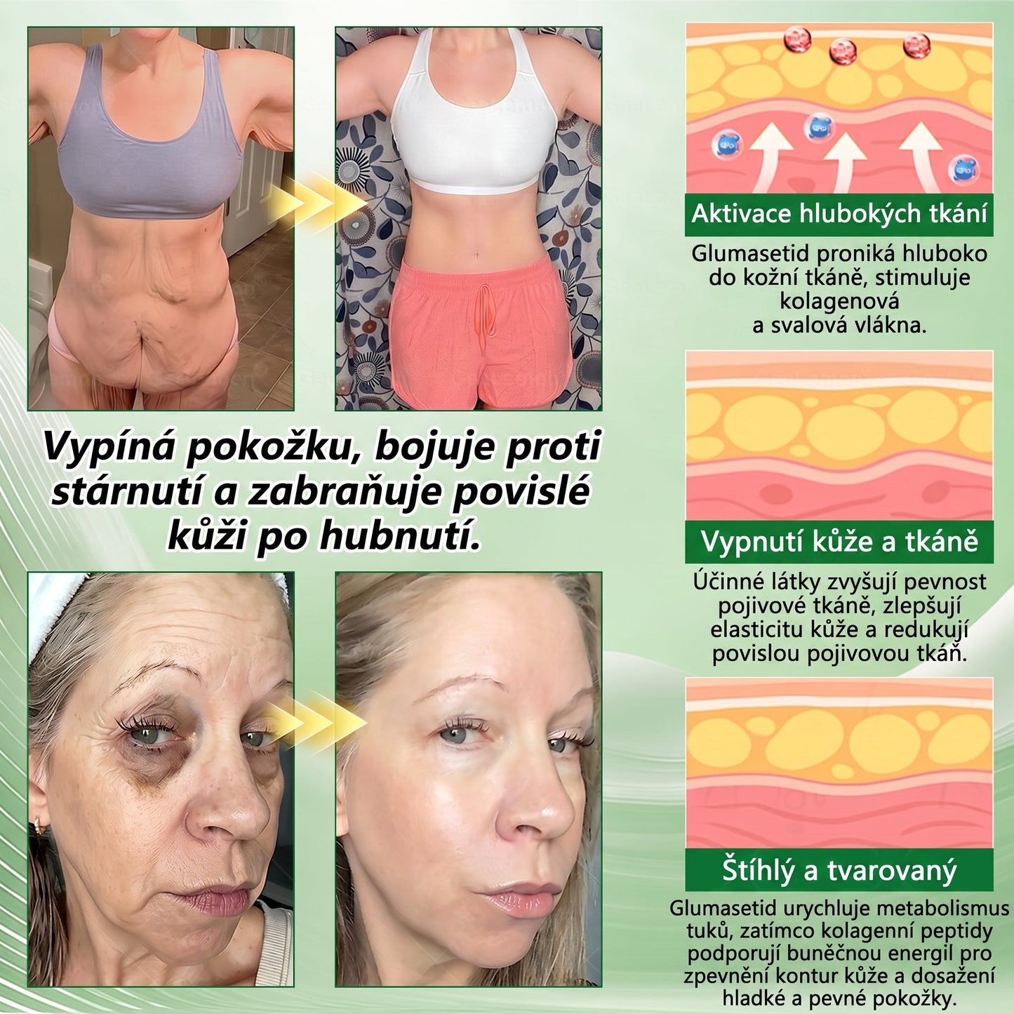 Luxarise®🌿Glumasetide 8v1 Stihla a zdrava nano mikrojehlickova naplast(1krát denně – viditelné změny až za 7 dní) ✅Pro obezitu, zpevnění kůže, cukrovku, spánkovou apnoe, klouby atd.