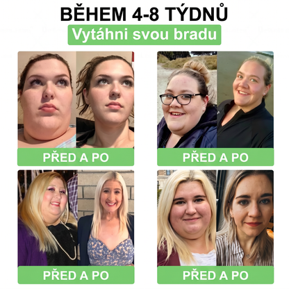 Luxarise®🌿Glumasetide 8v1 Stihla a zdrava nano mikrojehlickova naplast(1krát denně – viditelné změny až za 7 dní) ✅Pro obezitu, zpevnění kůže, cukrovku, spánkovou apnoe, klouby atd.