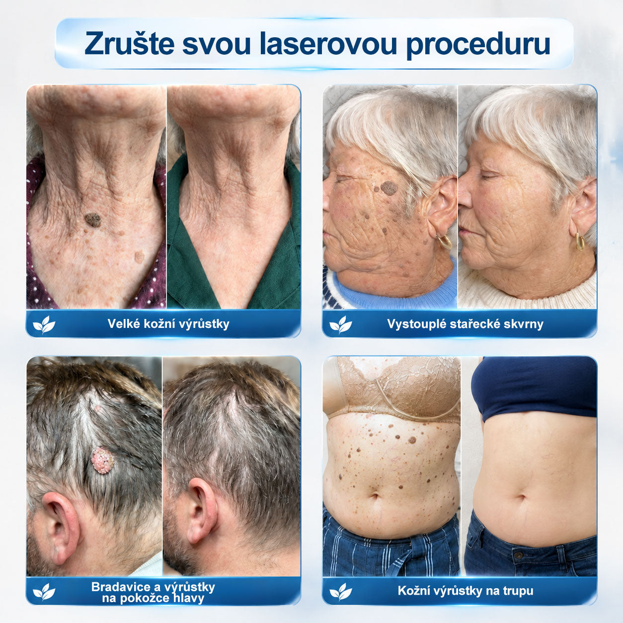 ✅☀️𝐎𝐟𝐢𝐜𝐢á𝐥𝐧í 𝐳𝐧𝐚č𝐤𝐨𝐯á 𝐩𝐫𝐨𝐝𝐞𝐣𝐧𝐚  𝐏𝐢𝐜𝐝𝐨® 𝟕𝐝𝐞𝐧𝐧í 𝐨𝐝𝐬𝐭𝐫𝐚ň𝐨𝐯𝐚č   𝐤𝐨ž𝐧í𝐜𝐡 𝐯ý𝐫ů𝐬𝐭𝐤ů 𝐚 𝐬𝐤𝐯𝐫𝐧(Nulová bolest, nulová kulička Rollerball) (Copy)