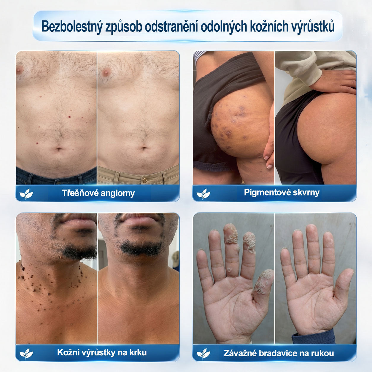 ✅☀️𝐎𝐟𝐢𝐜𝐢á𝐥𝐧í 𝐳𝐧𝐚č𝐤𝐨𝐯á 𝐩𝐫𝐨𝐝𝐞𝐣𝐧𝐚  𝐏𝐢𝐜𝐝𝐨® 𝟕𝐝𝐞𝐧𝐧í 𝐨𝐝𝐬𝐭𝐫𝐚ň𝐨𝐯𝐚č   𝐤𝐨ž𝐧í𝐜𝐡 𝐯ý𝐫ů𝐬𝐭𝐤ů 𝐚 𝐬𝐤𝐯𝐫𝐧(Nulová bolest, nulová kulička Rollerball) (Copy)