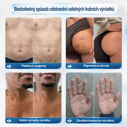 ✅☀️𝐎𝐟𝐢𝐜𝐢á𝐥𝐧í 𝐳𝐧𝐚č𝐤𝐨𝐯á 𝐩𝐫𝐨𝐝𝐞𝐣𝐧𝐚  𝐏𝐢𝐜𝐝𝐨® 𝟕𝐝𝐞𝐧𝐧í 𝐨𝐝𝐬𝐭𝐫𝐚ň𝐨𝐯𝐚č   𝐤𝐨ž𝐧í𝐜𝐡 𝐯ý𝐫ů𝐬𝐭𝐤ů 𝐚 𝐬𝐤𝐯𝐫𝐧(Nulová bolest, nulová kulička Rollerball) (Copy)