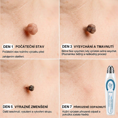 ✅☀️𝐎𝐟𝐢𝐜𝐢á𝐥𝐧í 𝐳𝐧𝐚č𝐤𝐨𝐯á 𝐩𝐫𝐨𝐝𝐞𝐣𝐧𝐚  𝐏𝐢𝐜𝐝𝐨® 𝟕𝐝𝐞𝐧𝐧í 𝐨𝐝𝐬𝐭𝐫𝐚ň𝐨𝐯𝐚č   𝐤𝐨ž𝐧í𝐜𝐡 𝐯ý𝐫ů𝐬𝐭𝐤ů 𝐚 𝐬𝐤𝐯𝐫𝐧(Nulová bolest, nulová kulička Rollerball) (Copy)