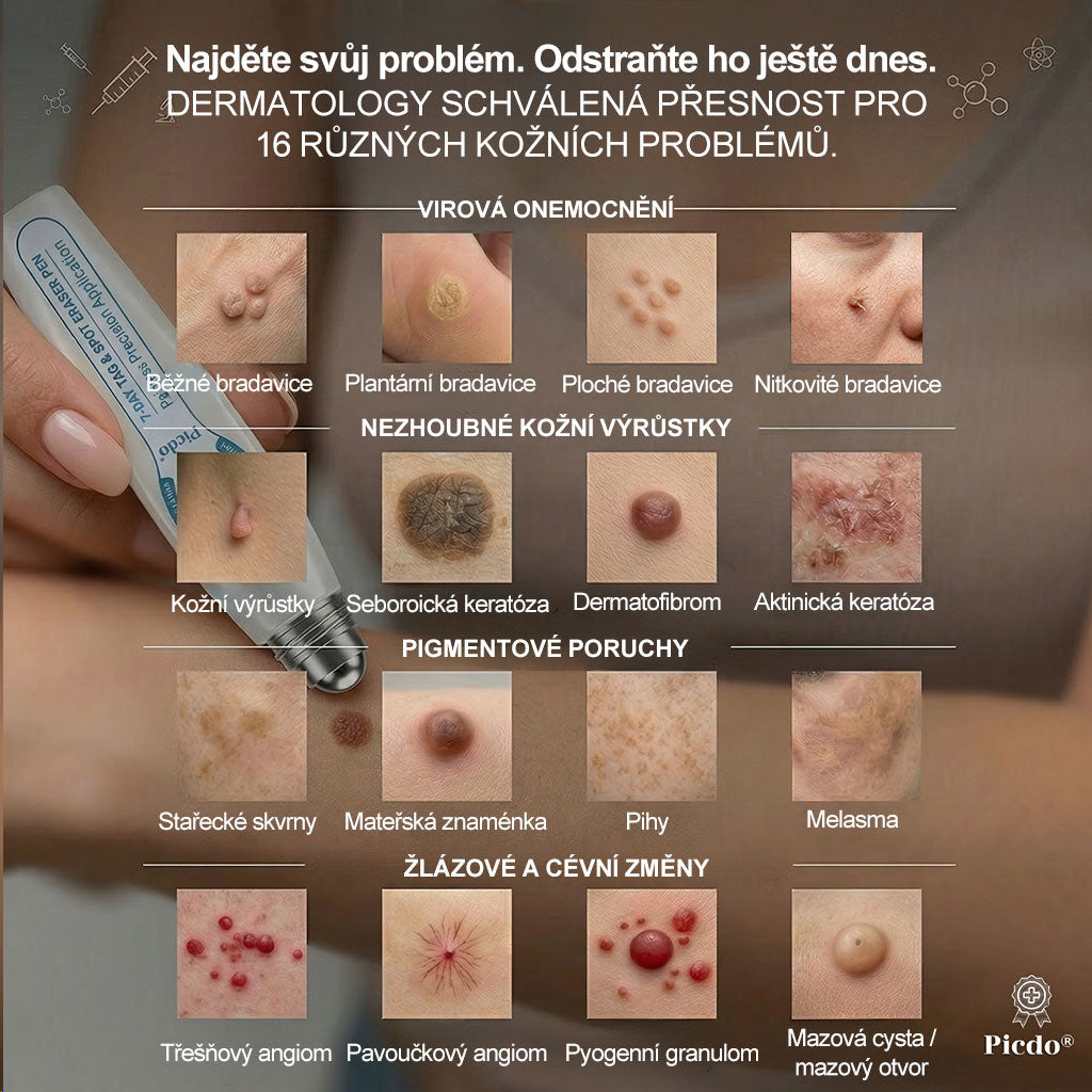 ✅☀️𝐎𝐟𝐢𝐜𝐢á𝐥𝐧í 𝐳𝐧𝐚č𝐤𝐨𝐯á 𝐩𝐫𝐨𝐝𝐞𝐣𝐧𝐚  𝐏𝐢𝐜𝐝𝐨® 𝟕𝐝𝐞𝐧𝐧í 𝐨𝐝𝐬𝐭𝐫𝐚ň𝐨𝐯𝐚č   𝐤𝐨ž𝐧í𝐜𝐡 𝐯ý𝐫ů𝐬𝐭𝐤ů 𝐚 𝐬𝐤𝐯𝐫𝐧(Nulová bolest, nulová kulička Rollerball) (Copy)
